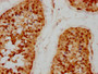 IHC image of CAC15696 diluted at 1:200 and staining in paraffin-embedded human testis tissue performed on a Leica BondTM system. After dewaxing and hydration, antigen retrieval was mediated by high pressure in a citrate buffer (pH 6.0). Section was blocked with 10% normal goat serum 30min at RT. Then primary antibody (1% BSA) was incubated at 4°C overnight. The primary is detected by a biotinylated secondary antibody and visualized using an HRP conjugated SP system.
