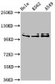 Western Blot, Positive WB detected in: Hela whole cell lysate, K562 whole cell lysate, A549 whole cell lysate, All lanes: XAB2 antibody at 3ug/ml, Secondary, Goat polyclonal to rabbit IgG at 1/50000 dilution, Predicted band size: 101 kDa, Observed band size: 101 kDa
