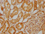 IHC image of CAC15702 diluted at 1:500 and staining in paraffin-embedded human kidney tissue performed on a Leica BondTM system. After dewaxing and hydration, antigen retrieval was mediated by high pressure in a citrate buffer (pH 6.0). Section was blocked with 10% normal goat serum 30min at RT. Then primary antibody (1% BSA) was incubated at 4°C overnight. The primary is detected by a biotinylated secondary antibody and visualized using an HRP conjugated SP system.