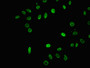 Immunofluorescence staining of Hela cells (treated with 30mM sodium butyrate for 4h) with CAC15716 at 1:12.5, counter-stained with DAPI. The cells were fixed in 4% formaldehyde, permeabilized using 0.2% Triton X-100 and blocked in 10% normal Goat Serum. The cells were then incubated with the antibody overnight at 4°C. The secondary antibody was Alexa Fluor 488-congugated AffiniPure Goat Anti-Rabbit IgG(H+L).