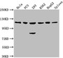 Western Blot, Positive WB detected in: Hela whole cell lysate, PC3 whole cell lysate, 293 whole cell lysate, K562 whole cell lysate, HepG2 whole cell lysate, Rat spleen tissue, All lanes: CDKL5 antibody at 1:2000, Secondary, Goat polyclonal to rabbit IgG at 1/50000 dilution, Predicted band size: 116, 108 kDa, Observed band size: 116 kDa