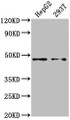 Western Blot, Positive WB detected in: HepG2 whole cell lysate, 293T whole cell lysate, All lanes: PSMD4 antibody at 1:2000, Secondary, Goat polyclonal to rabbit IgG at 1/50000 dilution, Predicted band size: 41, 29 kDa, Observed band size: 41 kDa