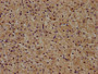 IHC image of CAC15732 diluted at 1:400 and staining in paraffin-embedded human adrenal gland tissue performed on a Leica BondTM system. After dewaxing and hydration, antigen retrieval was mediated by high pressure in a citrate buffer (pH 6.0). Section was blocked with 10% normal goat serum 30min at RT. Then primary antibody (1% BSA) was incubated at 4°C overnight. The primary is detected by a biotinylated secondary antibody and visualized using an HRP conjugated SP system.