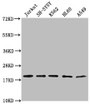 Western Blot, Positive WB detected in: Jurkat whole cell lysate, SH-SY5Y whole cell lysate, K562 whole cell lysate, HL-60 whole cell lysate, A549 whole cell lysate, All lanes: RPL24 antibody at 1:2000, Secondary, Goat polyclonal to rabbit IgG at 1/50000 dilution, Predicted band size: 18 kDa, Observed band size: 18 kDa