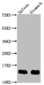 Western Blot, Positive WB detected in: Mouse spleen tissue, Mouse stomach tissue, All lanes: B2m antibody at 1:2000, Secondary, Goat polyclonal to rabbit IgG at 1/50000 dilution, Predicted band size: 14 kDa, Observed band size: 14 kDa