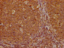 IHC image of CAC15748 diluted at 1:300 and staining in paraffin-embedded human tonsil tissue performed on a Leica BondTM system. After dewaxing and hydration, antigen retrieval was mediated by high pressure in a citrate buffer (pH 6.0). Section was blocked with 10% normal goat serum 30min at RT. Then primary antibody (1% BSA) was incubated at 4°C overnight. The primary is detected by a biotinylated secondary antibody and visualized using an HRP conjugated SP system.