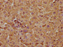 IHC image of CAC15752 diluted at 1:300 and staining in paraffin-embedded human liver tissue performed on a Leica BondTM system. After dewaxing and hydration, antigen retrieval was mediated by high pressure in a citrate buffer (pH 6.0). Section was blocked with 10% normal goat serum 30min at RT. Then primary antibody (1% BSA) was incubated at 4°C overnight. The primary is detected by a biotinylated secondary antibody and visualized using an HRP conjugated SP system.
