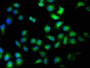 Immunofluorescence staining of Hela cells with CAC15752 at 1:100, counter-stained with DAPI. The cells were fixed in 4% formaldehyde, permeabilized using 0.2% Triton X-100 and blocked in 10% normal Goat Serum. The cells were then incubated with the antibody overnight at 4°C. The secondary antibody was Alexa Fluor 488-congugated AffiniPure Goat Anti-Rabbit IgG(H+L).