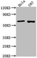 Western Blot, Positive WB detected in: Hela whole cell lysate, U87 whole cell lysate, All lanes: USP17L1 antibody at 1:2000, Secondary, Goat polyclonal to rabbit IgG at 1/50000 dilution, Predicted band size: 60 kDa, Observed band size: 60 kDa