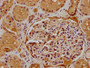 IHC image of CAC15755 diluted at 1:500 and staining in paraffin-embedded human kidney tissue performed on a Leica BondTM system. After dewaxing and hydration, antigen retrieval was mediated by high pressure in a citrate buffer (pH 6.0). Section was blocked with 10% normal goat serum 30min at RT. Then primary antibody (1% BSA) was incubated at 4°C overnight. The primary is detected by a biotinylated secondary antibody and visualized using an HRP conjugated SP system.