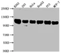 Western Blot, Positive WB detected in: K562 whole cell lysate, 293 whole cell lysate, Hela whole cell lysate, HepG2 whole cell lysate, PC3 whole cell lysate, MCF-7 whole cell lysate, All lanes: ITCH antibody at 1:2000, Secondary, Goat polyclonal to rabbit IgG at 1/50000 dilution, Predicted band size: 103, 99, 87 kDa, Observed band size: 103 kDa