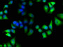 Immunofluorescence staining of Hela cells with CAC15759 at 1:100, counter-stained with DAPI. The cells were fixed in 4% formaldehyde, permeabilized using 0.2% Triton X-100 and blocked in 10% normal Goat Serum. The cells were then incubated with the antibody overnight at 4°C. The secondary antibody was Alexa Fluor 488-congugated AffiniPure Goat Anti-Rabbit IgG(H+L).