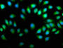 Immunofluorescence staining of A549 cells with CAC15765 at 1:50, counter-stained with DAPI. The cells were fixed in 4% formaldehyde, permeabilized using 0.2% Triton X-100 and blocked in 10% normal Goat Serum. The cells were then incubated with the antibody overnight at 4°C. The secondary antibody was Alexa Fluor 488-congugated AffiniPure Goat Anti-Rabbit IgG(H+L).