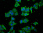 Immunofluorescence staining of HepG2 cells with CAC15770 at 1:100, counter-stained with DAPI. The cells were fixed in 4% formaldehyde, permeabilized using 0.2% Triton X-100 and blocked in 10% normal Goat Serum. The cells were then incubated with the antibody overnight at 4°C. The secondary antibody was Alexa Fluor 488-congugated AffiniPure Goat Anti-Rabbit IgG(H+L).