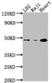 Western Blot, Positive WB detected in: L02 whole cell lysate, Raji whole cell lysate, Mouse heart tissue, All lanes: CASP9 antibody at 1:2000, Secondary, Goat polyclonal to rabbit IgG at 1/50000 dilution, Predicted band size: 47, 31, 18, 37 kDa, Observed band size: 47 kDa