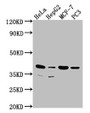 Western Blot, Positive WB detected in: Hela whole cell lysate, HepG2 whole cell lysate, MCF-7 whole cell lysate, PC3 whole cell lysate, All lanes: DUSP11 antibody at 1:2000, Secondary, Goat polyclonal to rabbit IgG at 1/50000 dilution, Predicted band size: 39, 26 kDa, Observed band size: 39 kDa