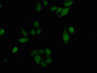 Immunofluorescence staining of HepG2 cells with CAC15780 at 1:100, counter-stained with DAPI. The cells were fixed in 4% formaldehyde, permeabilized using 0.2% Triton X-100 and blocked in 10% normal Goat Serum. The cells were then incubated with the antibody overnight at 4°C. The secondary antibody was Alexa Fluor 488-congugated AffiniPure Goat Anti-Rabbit IgG(H+L).