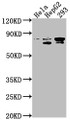 Western Blot, Positive WB detected in: Hela whole cell lysate, HepG2 whole cell lysate, 293 whole cell lysate, All lanes: SRPK2 antibody at 1:1000, Secondary, Goat polyclonal to rabbit IgG at 1/50000 dilution, Predicted band size: 78, 80 kDa, Observed band size: 78 kDa
