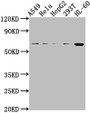 Western Blot, Positive WB detected in: A549 whole cell lysate, Hela whole cell lysate, HepG2 whole cell lysate, 293T whole cell lysate, HL60 whole cell lysate, All lanes: MDM2 antibody at 1:2000, Secondary, Goat polyclonal to rabbit IgG at 1/50000 dilution, Predicted band size: 56, 34, 31, 25, 36, 15, 12, 49, 50 kDa, Observed band size: 56 kDa