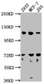 Western Blot, Positive WB detected in: 293T whole cell lysate, MCF-7 whole cell lysate, 293 whole cell lysate, All lanes: WDR59 antibody at 1:2000, Secondary, Goat polyclonal to rabbit IgG at 1/50000 dilution, Predicted band size: 110, 65, 63, 47 kDa, Observed band size: 110 kDa