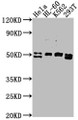 Western Blot, Positive WB detected in: HeLa whole cell lysate, HL-60 whole cell lysate, K562 whole cell lysate, 293T whole cell lysate, All lanes: DDX47 antibody at 1:2000, Secondary, Goat polyclonal to rabbit IgG at 1/50000 dilution, Predicted band size: 51, 46 kDa, Observed band size: 51 kDa Western Blot, Positive WB detected in: HeLa whole cell lysate, HL-60 whole cell lysate, K562 whole cell lysate, 293T whole cell lysate, All lanes: DDX47 antibody at 1:2000, Secondary, Goat polyclonal to rabbit IgG at 1/50000 dilution, Predicted band size: 51, 46 kDa, Observed band size: 51 kDa