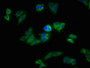 Immunofluorescence staining of HepG2 cells with CAC15802 at 1:213, counter-stained with DAPI. The cells were fixed in 4% formaldehyde, permeabilized using 0.2% Triton X-100 and blocked in 10% normal Goat Serum. The cells were then incubated with the antibody overnight at 4°C. The secondary antibody was Alexa Fluor 488-congugated AffiniPure Goat Anti-Rabbit IgG(H+L).