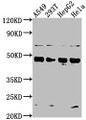 Western Blot, Positive WB detected in: A549 whole cell lysate, 293T whole cell lysate, HepG2 whole cell lysate, Hela whole cell lysate, All lanes: SNX5 antibody at 1:2000, Secondary, Goat polyclonal to rabbit IgG at 1/50000 dilution, Predicted band size: 47, 14 kDa, Observed band size: 47 kDa