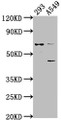 Western Blot, Positive WB detected in: 293 whole cell lysate, A549 whole cell lysate, All lanes: CRTAC1 antibody at 1:1000, Secondary, Goat polyclonal to rabbit IgG at 1/50000 dilution, Predicted band size: 72, 71, 69 kDa, Observed band size: 72 kDa