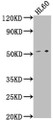 Western Blot, Positive WB detected in: HL60 whole cell lysate, All lanes: LCHN antibody at 1:1000, Secondary, Goat polyclonal to rabbit IgG at 1/50000 dilution, Predicted band size: 52 kDa, Observed band size: 52 kDa