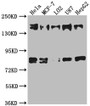Western Blot, Positive WB detected in: Hela whole cell lysate, MCF-7 whole cell lysate, L02 whole cell lysate, U87 whole cell lysate, HepG2 whole cell lysate, All lanes: ZFYVE9 antibody at 1:1000, Secondary, Goat polyclonal to rabbit IgG at 1/50000 dilution, Predicted band size: 157, 151, 84 kDa, Observed band size: 157 kDa