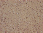IHC image of CAC15820 diluted at 1:100 and staining in paraffin-embedded human adrenal gland tissue performed on a Leica BondTM system. After dewaxing and hydration, antigen retrieval was mediated by high pressure in a citrate buffer (pH 6.0). Section was blocked with 10% normal goat serum 30min at RT. Then primary antibody (1% BSA) was incubated at 4°C overnight. The primary is detected by a biotinylated secondary antibody and visualized using an HRP conjugated SP system.