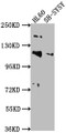 Western Blot, Positive WB detected in: HL60 whole cell lysate, SH-SY5Y whole cell lysate, All lanes: RAPGEF1 antibody at 1:2000, Secondary, Goat polyclonal to rabbit IgG at 1/50000 dilution, Predicted band size: 121, 117, 123 kDa, Observed band size: 121 kDa