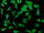 Immunofluorescence staining of SH-SY5Y cells with CAC15823 at 1:50, counter-stained with DAPI. The cells were fixed in 4% formaldehyde, permeabilized using 0.2% Triton X-100 and blocked in 10% normal Goat Serum. The cells were then incubated with the antibody overnight at 4°C. The secondary antibody was Alexa Fluor 488-congugated AffiniPure Goat Anti-Rabbit IgG(H+L).