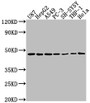 Western Blot, Positive WB detected in: U87 whole cell lysate, HepG2 whole cell lysate, A549 whole cell lysate, PC-3 whole cell lysate, SH-SY5Y whole cell lysate, THP-1 whole cell lysate, Hela whole cell lysate, All lanes: NDRG1 antibody at 1:2000, Secondary, Goat polyclonal to rabbit IgG at 1/50000 dilution, Predicted band size: 43, 36, 34 kDa, Observed band size: 43 kDa