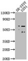 Western Blot, Positive WB detected in: SH-SY5Y whole cell lysate, U251 whole cell lysate, All lanes: CSRNP3 antibody at 1:2000, Secondary, Goat polyclonal to rabbit IgG at 1/50000 dilution, Predicted band size: 65, 59 kDa, Observed band size: 65 kDa