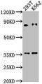 Western Blot, Positive WB detected in: 293T whole cell lysate, K562 whole cell lysate, All lanes: SNRK antibody at 1:2000, Secondary, Goat polyclonal to rabbit IgG at 1/50000 dilution, Predicted band size: 85, 28 kDa, Observed band size: 85 kDa
