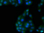 Immunofluorescence staining of Hela cells with CAC15831 at 1:133, counter-stained with DAPI. The cells were fixed in 4% formaldehyde, permeabilized using 0.2% Triton X-100 and blocked in 10% normal Goat Serum. The cells were then incubated with the antibody overnight at 4°C. The secondary antibody was Alexa Fluor 488-congugated AffiniPure Goat Anti-Rabbit IgG(H+L).
