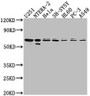 Western Blot, Positive WB detected in: U251 whole cell lysate, NTERA-2 whole cell lysate, Hela whole cell lysate, SH-SY5Y whole cell lysate, HL60 whole cell lysate, PC-3 whole cell lysate, A549 whole cell lysate, All lanes: CDK17 antibody at 1:2000, Secondary, Goat polyclonal to rabbit IgG at 1/50000 dilution, Predicted band size: 60 kDa, Observed band size: 60 kDa