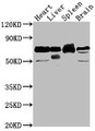 Western Blot, Positive WB detected in: Rat heart tissue, Rat liver tissue, Rat spleen tissue, Rat brain tissue, All lanes: Alb antibody at 1:2000, Secondary, Goat polyclonal to rabbit IgG at 1/50000 dilution, Predicted band size: 69 kDa, Observed band size: 69 kDa