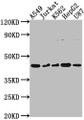 Western Blot, Positive WB detected in: A549 whole cell lysate, Jurkat whole cell lysate, K562 whole cell lysate, HepG2 whole cell lysate, U87 whole cell lysate, All lanes: DNASE2B antibody at 1:2000, Secondary, Goat polyclonal to rabbit IgG at 1/50000 dilution, Predicted band size: 42, 18 kDa, Observed band size: 42 kDa Western Blot, Positive WB detected in: A549 whole cell lysate, Jurkat whole cell lysate, K562 whole cell lysate, HepG2 whole cell lysate, U87 whole cell lysate, All lanes: DNASE2B antibody at 1:2000, Secondary, Goat polyclonal to rabbit IgG at 1/50000 dilution, Predicted band size: 42, 18 kDa, Observed band size: 42 kDa