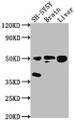Western Blot, Positive WB detected in: SH-SY5Y whole cell lysate, Rat brain tissue, Rat liver tissue, All lanes: SEPT11 antibody at 1:2000, Secondary, Goat polyclonal to rabbit IgG at 1/50000 dilution, Predicted band size: 50, 51 kDa, Observed band size: 50 kDa