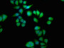 Immunofluorescence staining of Hela cells with CAC15855 at 1:133, counter-stained with DAPI. The cells were fixed in 4% formaldehyde, permeabilized using 0.2% Triton X-100 and blocked in 10% normal Goat Serum. The cells were then incubated with the antibody overnight at 4°C. The secondary antibody was Alexa Fluor 488-congugated AffiniPure Goat Anti-Rabbit IgG(H+L).