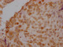 IHC image of CAC15857 diluted at 1:100 and staining in paraffin-embedded human placenta tissue performed on a Leica BondTM system. After dewaxing and hydration, antigen retrieval was mediated by high pressure in a citrate buffer (pH 6.0). Section was blocked with 10% normal goat serum 30min at RT. Then primary antibody (1% BSA) was incubated at 4°C overnight. The primary is detected by a Goat anti-rabbit IgG polymer labeled by HRP and visualized using 0.05% DAB.