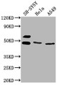 Western Blot, Positive WB detected in: SH-SY5Y whole cell lysate, Hela whole cell lysate, A549 whole cell lysate, All lanes: ANGPTL4 antibody at 1:1000, Secondary, Goat polyclonal to rabbit IgG at 1/50000 dilution, Predicted band size: 46, 41, 27 kDa, Observed band size: 46 kDa