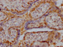 IHC image of CAC15862 diluted at 1:400 and staining in paraffin-embedded human placenta tissue performed on a Leica BondTM system. After dewaxing and hydration, antigen retrieval was mediated by high pressure in a citrate buffer (pH 6.0). Section was blocked with 10% normal goat serum 30min at RT. Then primary antibody (1% BSA) was incubated at 4°C overnight. The primary is detected by a Goat anti-rabbit IgG labeled by HRP and visualized using 0.05% DAB.