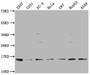 Western Blot, Positive WB detected in: 293T whole cell lysate, U251 whole cell lysate, PC-3 whole cell lysate, Hela whole cell lysate, U87 whole cell lysate, HepG2 whole cell lysate, A549 whole cell lysate, All lanes: FABP4 antibody at 1:1000, Secondary, Goat polyclonal to rabbit IgG at 1/50000 dilution, Predicted band size: 15 kDa, Observed band size: 15 kDa