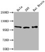Western Blot, Positive WB detected in: Hela whole cell lysate, 293 whole cell lysate, Rat Brain tissue, All lanes: ACTN2 antibody at 1:2000, Secondary, Goat polyclonal to rabbit IgG at 1/50000 dilution, Predicted band size: 104 kDa, Observed band size: 104 kDa