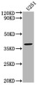 Western Blot, Positive WB detected in: U251 whole cell lysate, All lanes: FST antibody at 1:2000, Secondary, Goat polyclonal to rabbit IgG at 1/50000 dilution, Predicted band size: 39, 35 kDa, Observed band size: 39 kDa