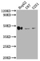 Western Blot, Positive WB detected in: HepG2 whole cell lysate, U87 whole cell lysate, U251 whole cell lysate, All lanes: HLA-G antibody at 1:2000, Secondary, Goat polyclonal to rabbit IgG at 1/50000 dilution, Predicted band size: 39, 28, 18, 37, 26, 14 kDa, Observed band size: 45 kDa