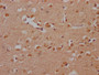 IHC image of CAC15899 diluted at 1:200 and staining in paraffin-embedded human brain tissue performed on a Leica BondTM system. After dewaxing and hydration, antigen retrieval was mediated by high pressure in a citrate buffer (pH 6.0). Section was blocked with 10% normal goat serum 30min at RT. Then primary antibody (1% BSA) was incubated at 4°C overnight. The primary is detected by a Goat anti-rabbit polymer IgG labeled by HRP and visualized using 0.05% DAB.